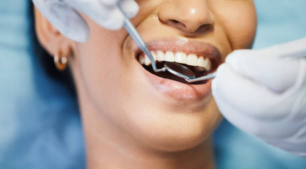 Best Emergency Wisdom Teeth Removal in Highland Park, IL